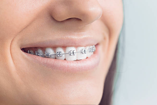 Best Dental Inlays and Onlays  in Hazel Dell, WA